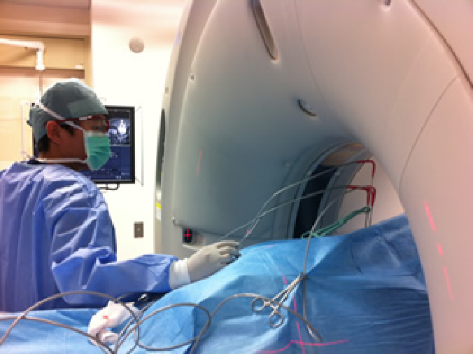 腎がん、骨軟部腫瘍に対する凍結療法1