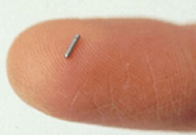 ヨウ素125を用いた前立腺がん永久挿入密封小線源療法2